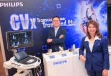 ฟิลิปส์ ยกระดับอัลตราซาวด์! เปิดตัว ‘Transcend Plus’ บนรุ่น EPIQ-Affiniti CVx ชู AI การแพทย์มาตรฐาน FDA สหรัฐฯ